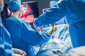 Advantages of Laparoscopic Surgery